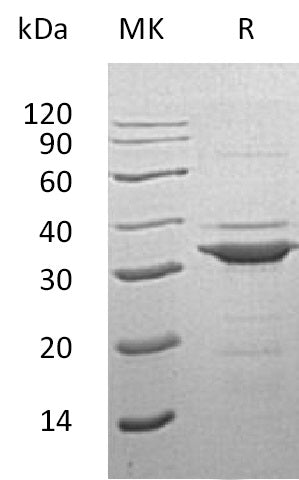 Recombinant Human TPM3
