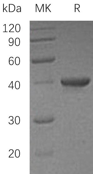 Recombinant Human UBE2I (N-GST)