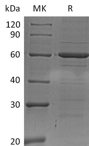 Recombinant Human IRF5 (C-6His)