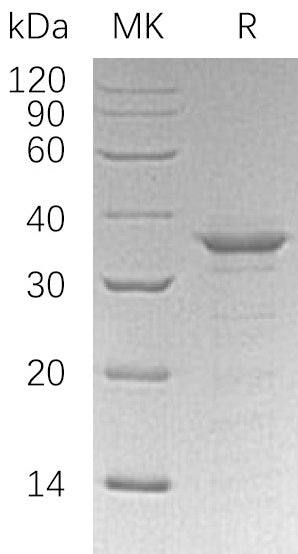 Recombinant Human ETS1 (N-6His)