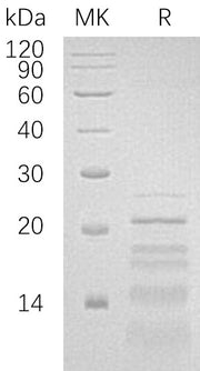 Recombinant Human PHLDA2 (C-6His)