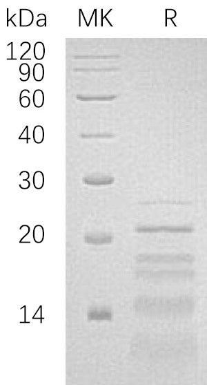 Recombinant Human PHLDA2 (C-6His)