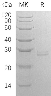 Recombinant Human RPE (C-6His)