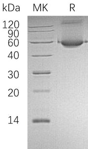 Recombinant Human ALDH1A1 (N-6His)