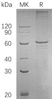 Recombinant Human SMAD4 (C-6His)