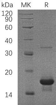 Recombinant Human SH2D1A (N-6His)