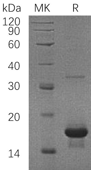 Recombinant Human SH2D1A (N-6His)