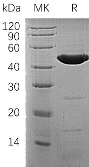 Recombinant Human ACADM (N-6His)