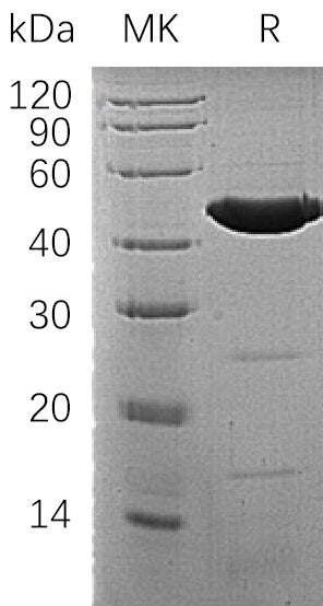 Recombinant Human ACADM (N-6His)