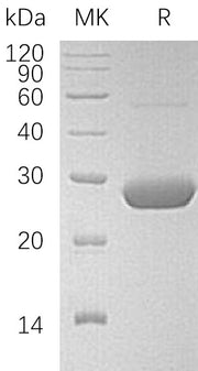 Recombinant Human LYPLA2 (C-6His)