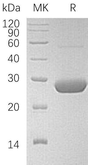 Recombinant Human LYPLA2 (C-6His)