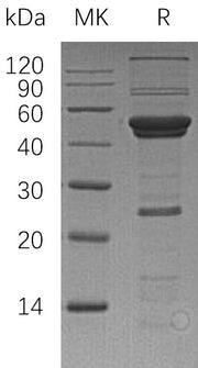 Recombinant Human ATG4A (N-6His)