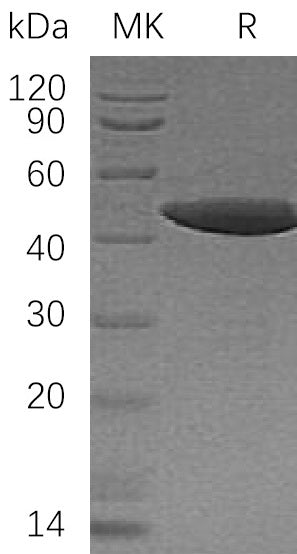 Recombinant Human NCK1 (N-6His)