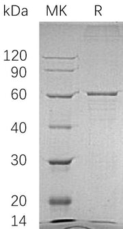 Recombinant Human BLK (C-6His)