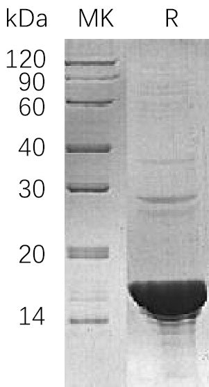 Recombinant Human UBE2B