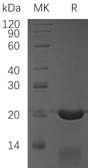 Recombinant Human CRADD