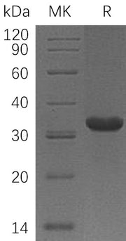 Recombinant Human HABP1 (C-6His)