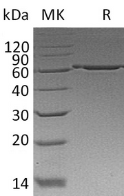 Recombinant Human P4HB (C-6His)
