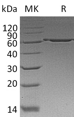 Recombinant Human P4HB (C-6His)
