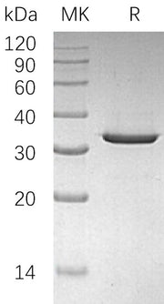 Recombinant Human SULT4A1