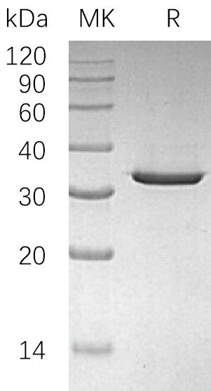 Recombinant Human SULT4A1