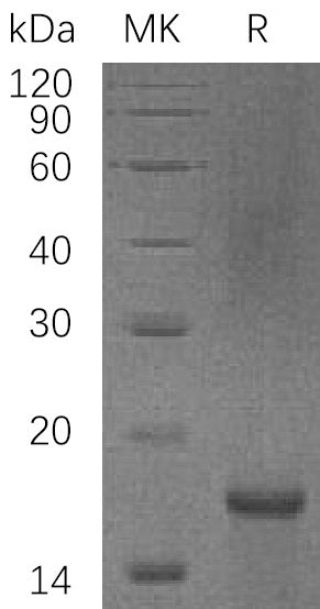 Recombinant Human PDCD4 (C-6His)
