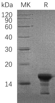 Recombinant Human SNCG