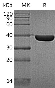 Recombinant Human HSP40 (C-6His)