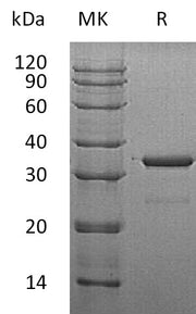 Recombinant Human SULT1A3 (N-6His)