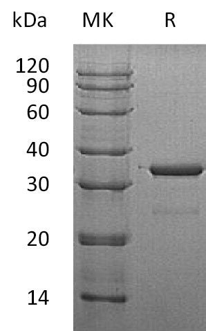 Recombinant Human SULT1A3 (N-6His)