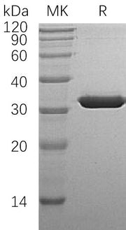 Recombinant Human SULT1A1 (N-6His)
