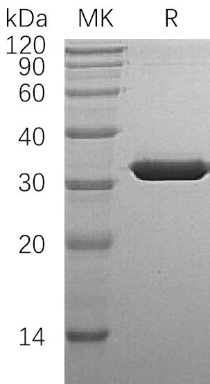Recombinant Human SULT1A1 (N-6His)