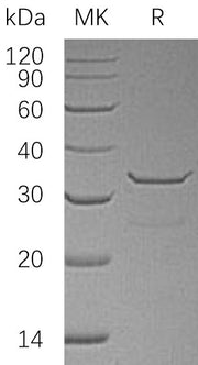 Recombinant Human SULT1B1 (N-6His)