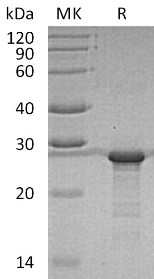 Recombinant Human YKT6 (N-6His)