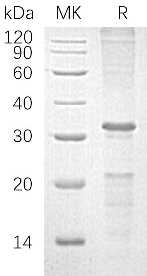 Recombinant Human CASP10 (C-6His)