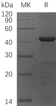Recombinant Human OBFc1 (N-6His)
