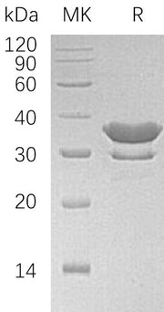 Recombinant Human SULT2A1 (N-6His)