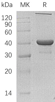 Recombinant Human NANS (N-6His)