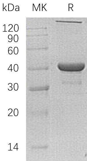 Recombinant Human NANS (N-6His)