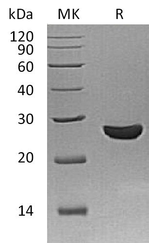 Recombinant Schistosoma Japonicum GST
