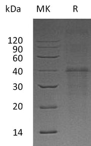 Recombinant Human Carbonic Anhydrase 14 (N-6His)