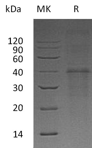 Recombinant Human Carbonic Anhydrase 14 (N-6His)