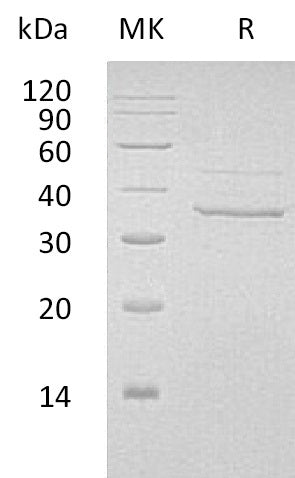 Recombinant Human MYOZ2 (C-6His)