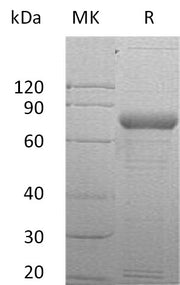 Recombinant Human SIRPG (C-Fc)