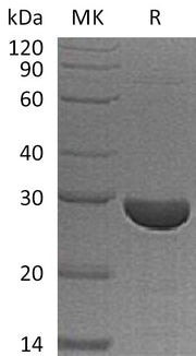 Recombinant Human S100A13