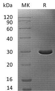 Recombinant Human CASP14 (C-6His)