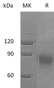 Recombinant Human DR6 (C-Fc)