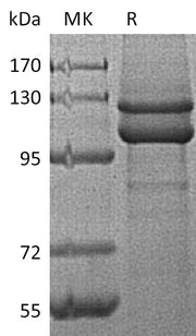 Recombinant Human CDH1 (C-6His)
