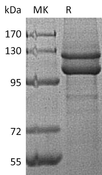 Recombinant Human CDH1 (C-6His)