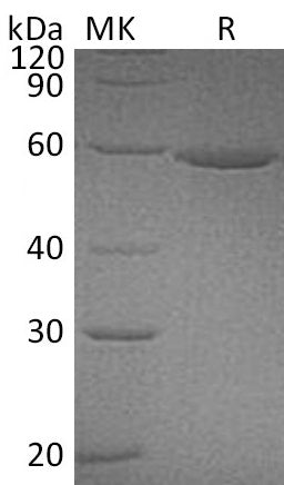 Recombinant Human ALDH3A1 (C-6His)